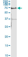 5 - ALPPL2 Antibody (monoclonal) (M07) AT1125a