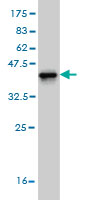 1 - ARHGAP4 Antibody (monoclonal) (M01) AT1179a