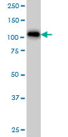 1 - ARHGAP4 Antibody (monoclonal) (M01) AT1179a