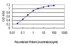 10 - ARMC8 Antibody (monoclonal) (M01) AT1196a