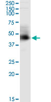 5 - ARMC8 Antibody (monoclonal) (M01) AT1196a