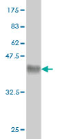 1 - ARMC8 Antibody (monoclonal) (M01) AT1196a