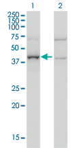 1 - ARMC8 Antibody (monoclonal) (M01) AT1196a