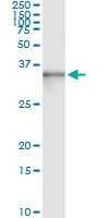 5 - ASB9 Antibody (monoclonal) (M01) AT1211a