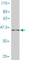 1 - ASF1B Antibody (monoclonal) (M01) AT1212a