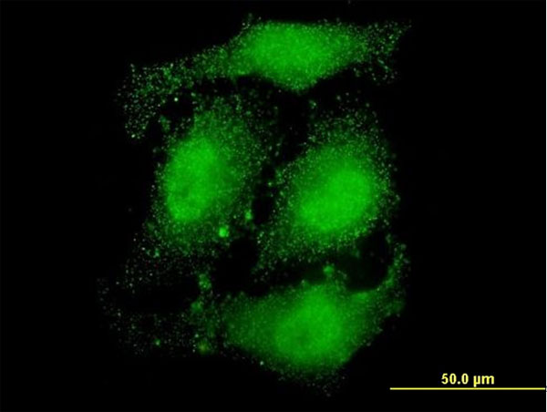 3 - ATN1 Antibody (monoclonal) (M01) AT1225a