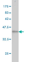 1 - ATN1 Antibody (monoclonal) (M01) AT1225a