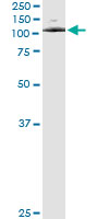 5 - ATP2C1 Antibody (monoclonal) (M01) AT1236a