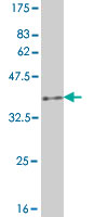 1 - B3GNT1 Antibody (monoclonal) (M05) AT1254a