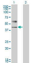 1 - B3GNT1 Antibody (monoclonal) (M05) AT1254a