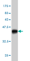 1 - B4GALNT1 Antibody (monoclonal) (M02) AT1255a