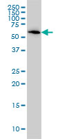 1 - B4GALNT1 Antibody (monoclonal) (M02) AT1255a