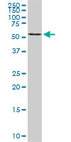 1 - B4GALNT1 Antibody (monoclonal) (M02) AT1255a