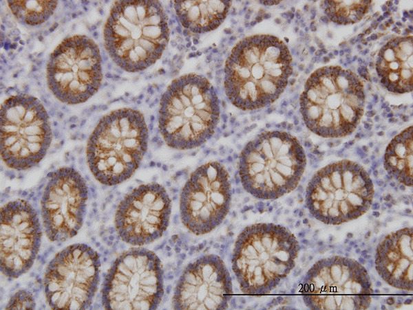 2 - BAIAP2L1 Antibody (monoclonal) (M01) AT1264a