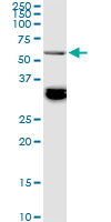 1 - BAIAP2L1 Antibody (monoclonal) (M01) AT1264a