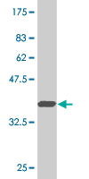 1 - BARHL1 Antibody (monoclonal) (M01) AT1269a