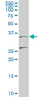 1 - BARHL1 Antibody (monoclonal) (M01) AT1269a