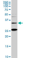 1 - BARHL1 Antibody (monoclonal) (M01) AT1269a