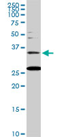1 - BARHL1 Antibody (monoclonal) (M01) AT1269a