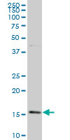 1 - BATF Antibody (monoclonal) (M03) AT1273a