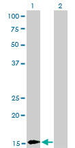 1 - BATF Antibody (monoclonal) (M03) AT1273a