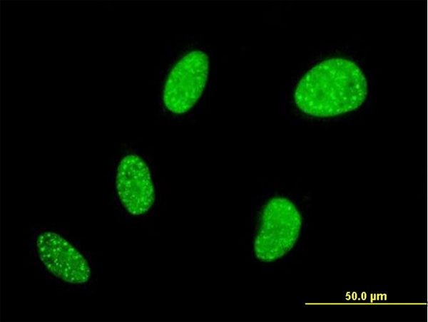 3 - BCL7B Antibody (monoclonal) (M01) AT1284a