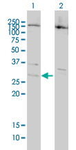1 - BCL7B Antibody (monoclonal) (M01) AT1284a