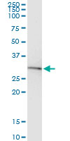 5 - BDNF Antibody (monoclonal) (M02) AT1290a
