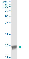 5 - BIRC5 Antibody (monoclonal) (M01) AT1299a