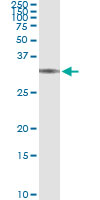 5 - BRMS1 Antibody (monoclonal) (M01) AT1311a