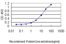 10 - C1orf33 Antibody (monoclonal) (M01) AT1336a