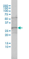 1 - C1orf33 Antibody (monoclonal) (M01) AT1336a