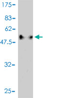 1 - C1QTNF2 Antibody (monoclonal) (M01) AT1339a