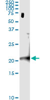 5 - C22orf18 Antibody (monoclonal) (M01) AT1344a