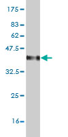 1 - C4B Antibody (monoclonal) (M01) AT1346a