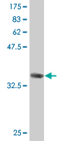 1 - C9orf98 Antibody (monoclonal) (M01) AT1353a