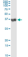 5 - CA1 Antibody (monoclonal) (M05) AT1355a