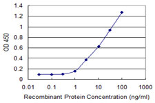 10 - CABP4 Antibody (monoclonal) (M02) AT1363a