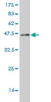 1 - CABP4 Antibody (monoclonal) (M02) AT1363a