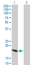 1 - CABP4 Antibody (monoclonal) (M02) AT1363a