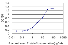 10 - CACNA1I Antibody (monoclonal) (M02) AT1364a