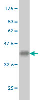 1 - CACNA1I Antibody (monoclonal) (M02) AT1364a