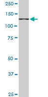 1 - CAND1 Antibody (monoclonal) (M05) AT1383a