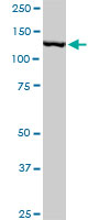 1 - CAND1 Antibody (monoclonal) (M05) AT1383a