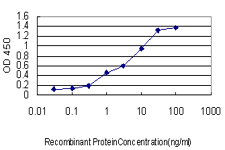10 - CANT1 Antibody (monoclonal) (M01) AT1384a
