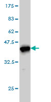 1 - CANT1 Antibody (monoclonal) (M01) AT1384a