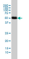 1 - CANT1 Antibody (monoclonal) (M01) AT1384a