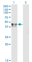 1 - CANT1 Antibody (monoclonal) (M01) AT1384a