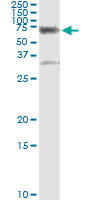 5 - CBS Antibody (monoclonal) (M01) AT1408a