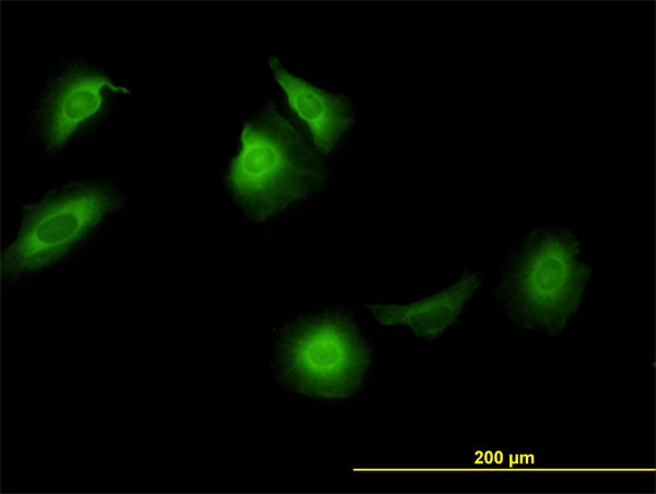 3 - CCT5 Antibody (monoclonal) (M01) AT1428a